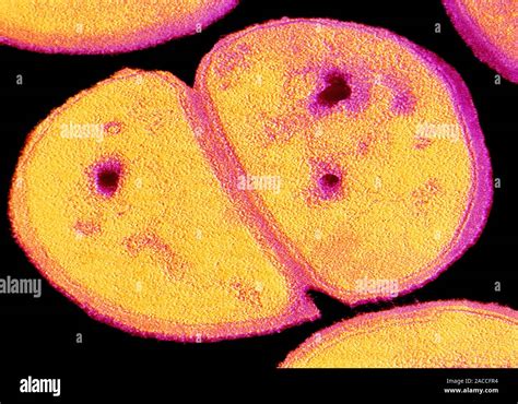 False Colour Transmission Electron Micrograph Tem Of Staphylococcus