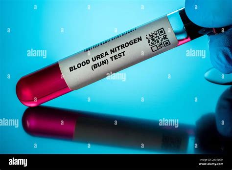 Blood Urea Nitrogen BUN Test Blood Tests For Older Adults