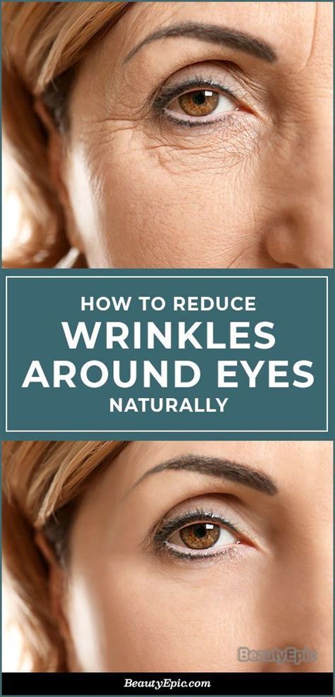 How To Get Rid Of Under Eye Wrinkles Naturally Artofit