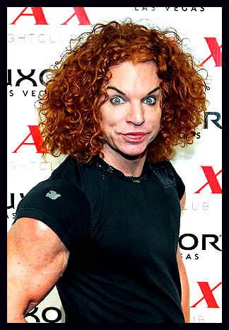 Carrot Top Plastic Surgery Botox Injections, Browlift Before and After