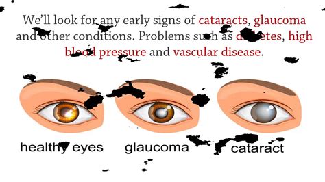 Eye Test At Oakes Opticians Youtube