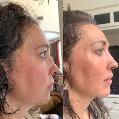 Photo Gallery | Austin Regenerative Therapy