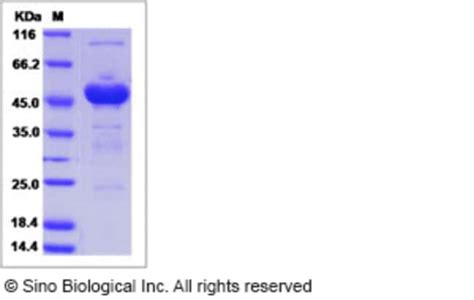 Sino Biological Human Tmed Protein Fc Tag Ug Quantity Each Of