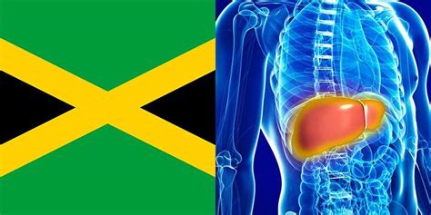 Liver Disease In Jamaica