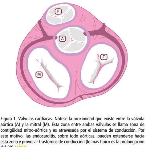 Fisiopatología De La Estenosis De La Válvula Mitral