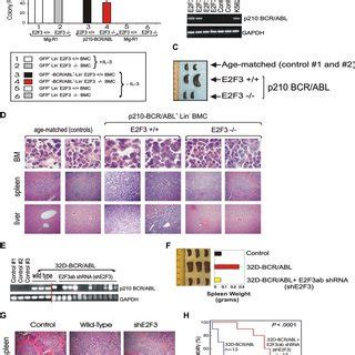 In Vitro And In Vivo Requirement Of E2F3 For BCR ABL Leukemogenesis