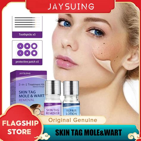 Jaysuing Warts Remover Liquid Antibacterial Ointment Wart Treatment