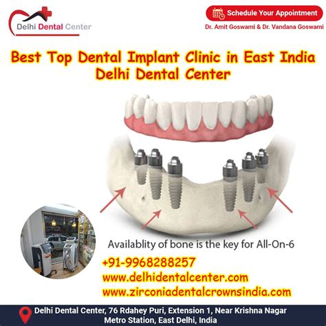 Best Top All In 4 Dental Implant Dentist India All On 4 Dental