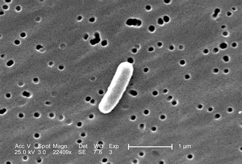 Free picture: single, gram, negative, escherichia coli, bacterium