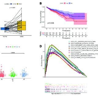 The expression of TGFβ1 in CC patients and the association with