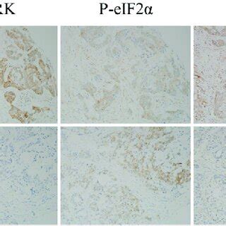 Representative Immunohistochemical Staining Images Of Er Stress And