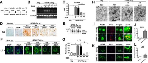 Hiv Tat Alters Neuronal Autophagy By Modulating Autophagosome Fusion