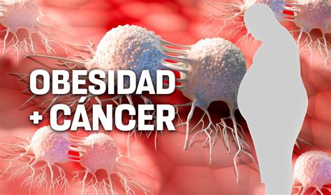 Obesidad factor de riesgo para padecer algún tipo de cáncer UNAM Global