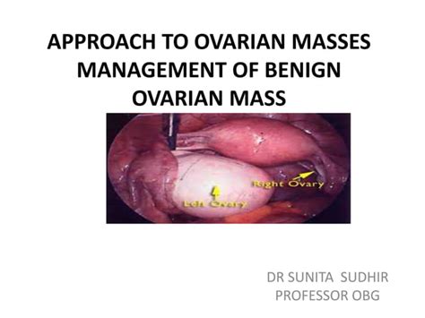 Aproach To Ovarian Masses And Managemnt Of Benign Ovarian Masses Ppt