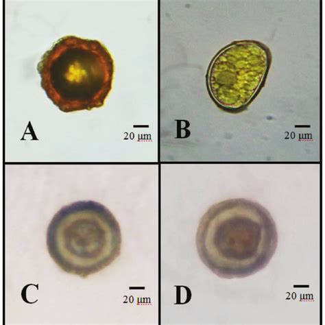 Soil Transmitted Helminths Eggs Observed In Selected Elementary Schools