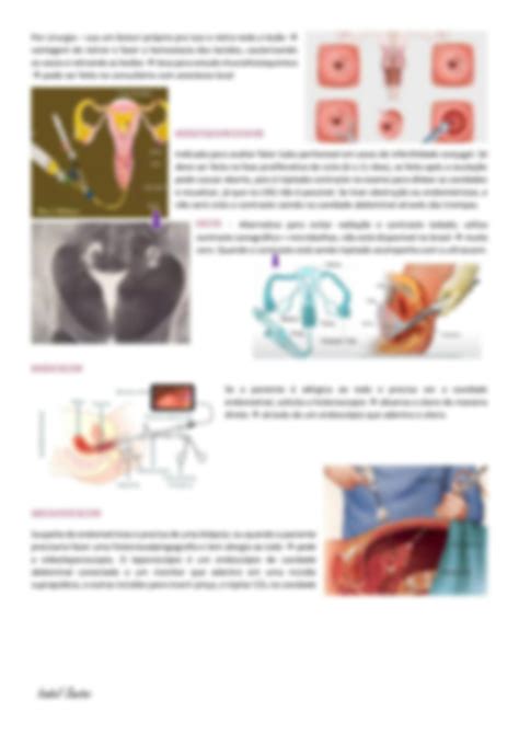 Solution Aula Exames Complementares Studypool