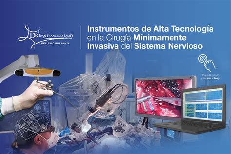 Instrumentos De Alta Tecnolog A En La Cirug A M Nimamente Invasiva Dr