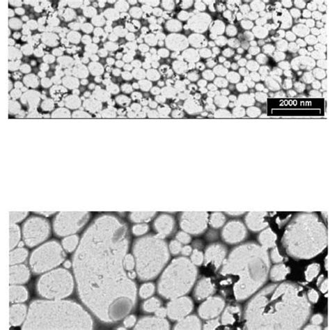 Electron Transmission Microphotography Of Pfc Cd Nanocapsules