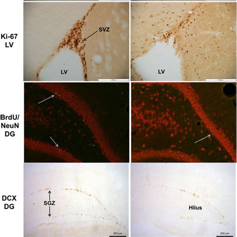 Representative Photomicrographs Of Ki 67 And Dcx Positive Cells In The Download Scientific