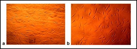 Photomicrographs × 40—cell Proliferation Of Dpscs Was Found To Be