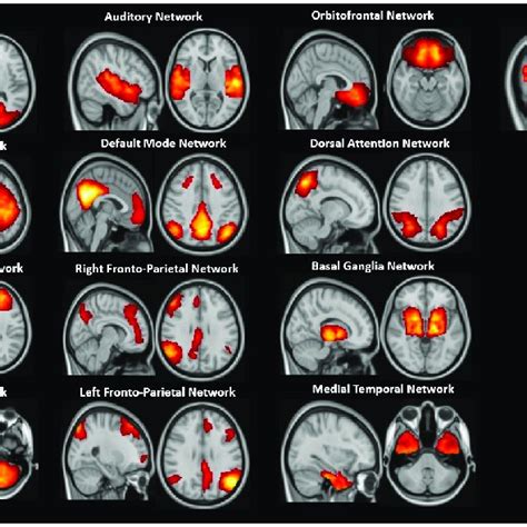 Resting State Networks Rsns Extracted From The Whole Group Of Download Scientific Diagram