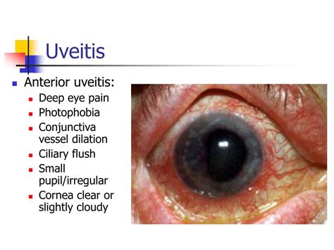 PPT - The Differential Diagnosis of The Red Eye PowerPoint Presentation ...