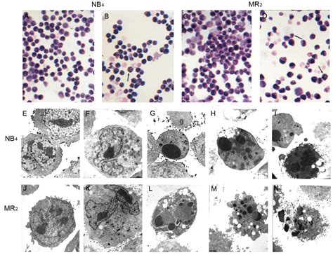 Realgar Induced Apoptosis And Differentiation In All Trans Retinoic