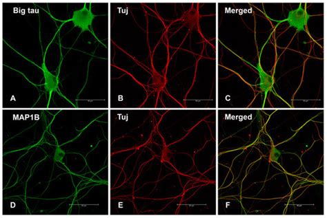 Cells Free Full Text Regulation Of Tau Expression In Superior