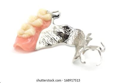 1 072 Metal Partial Denture Images Stock Photos 3D Objects Vectors