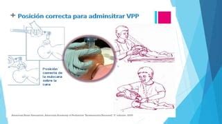 RCP neonatal para enfermería PPT