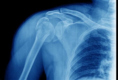 Musculoskeletal Radiograph Interpretation Generic Approach Oscestop