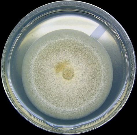 Aspergillus Nidulans Med Lab Plant Pathology Eukaryotic Cell Cell