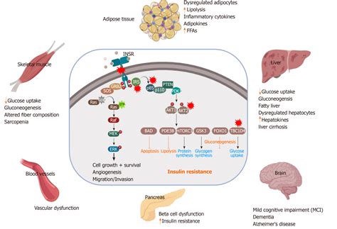 Pathophysiology Of Insulin Resistance