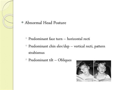 Diplopia Charting