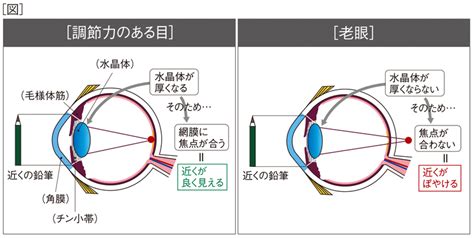 年代別に見る「目」の病気～スマホ老眼・リアル老眼・緑内障・白内障・加齢黄斑変性～ せいてつlab 社会医療法人 製鉄記念八幡病院