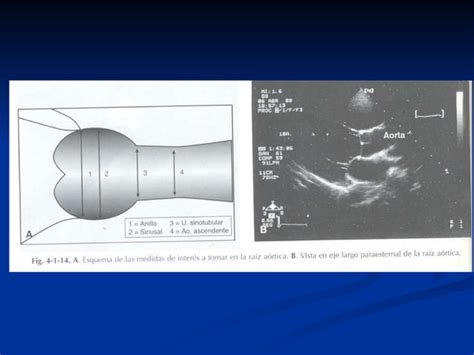 Cortes Ecocardiogr Ficos Ppt