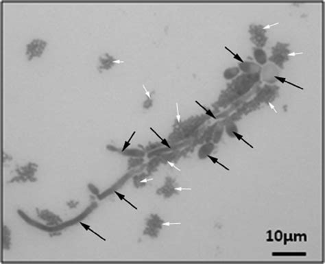 Streptococcus Salivarius Gram Stain