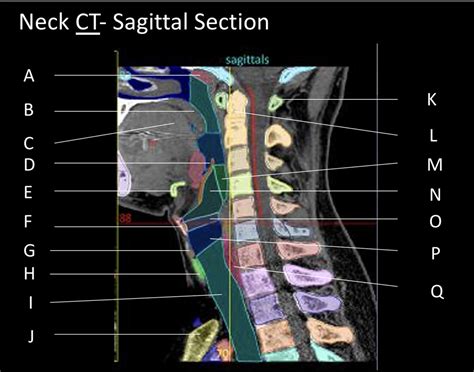 Sagittal Section Diagram Quizlet