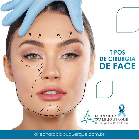 Tipos De Cirurgia De Face