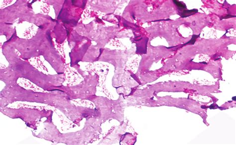 Photomicrograph Of The Histopathological Examination H E Staining Of