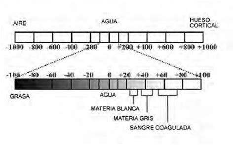 Esquema Que Representa La Escala De Hounsfield Utilizada Para