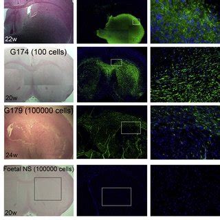 (PDF) Glioma Stem Cell Lines Expanded in Adherent Culture Have Tumor ... 