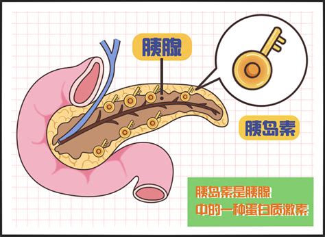 糖尿病 糖 糖尿病足 胰岛素 胰腺 血糖 血压仪 空腹血糖 测血糖 三高一少 口渴 尿多 尿频 肥胖 1型糖尿病 2型糖尿病