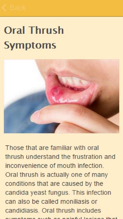 Symptoms Of Thrush by Gary O Brien