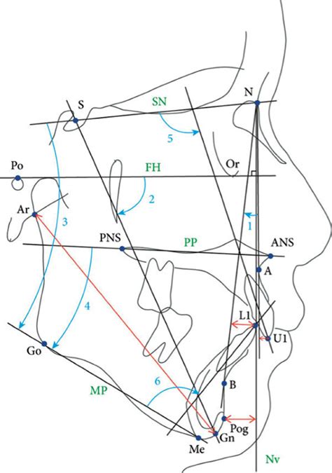 Cephalometric Tracing Of Angular Measurements Cephalometric Landmarks