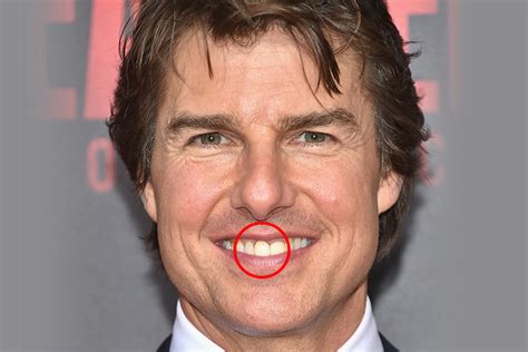 This Famous Actor S Teeth R Thingsyoucantunsee