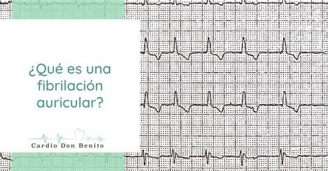 Qu Es Una Fibrilaci N Auricular Qu Consecuencias Puede Tener