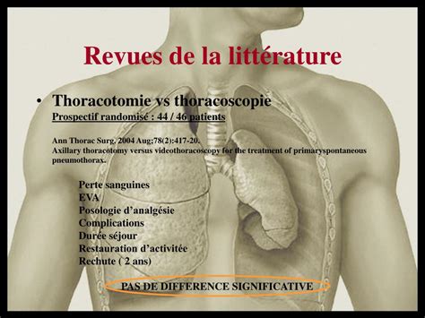 Ppt Traitement Chirurgical Du Pneumothorax Spontan Powerpoint