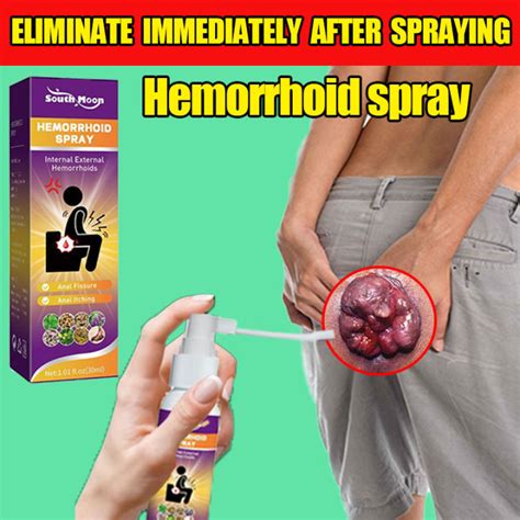 【painless Removal】south Moon Anal Hemorrhoid Spray Original 30ml Professional Hemorrhoid Removal