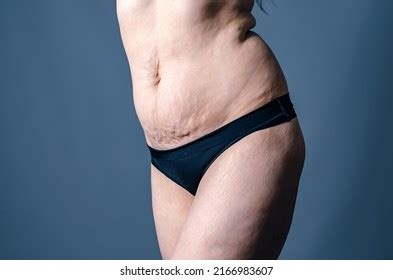 Thousand Obese Naked Woman Royalty Free Images Stock Photos Pictures Shutterstock